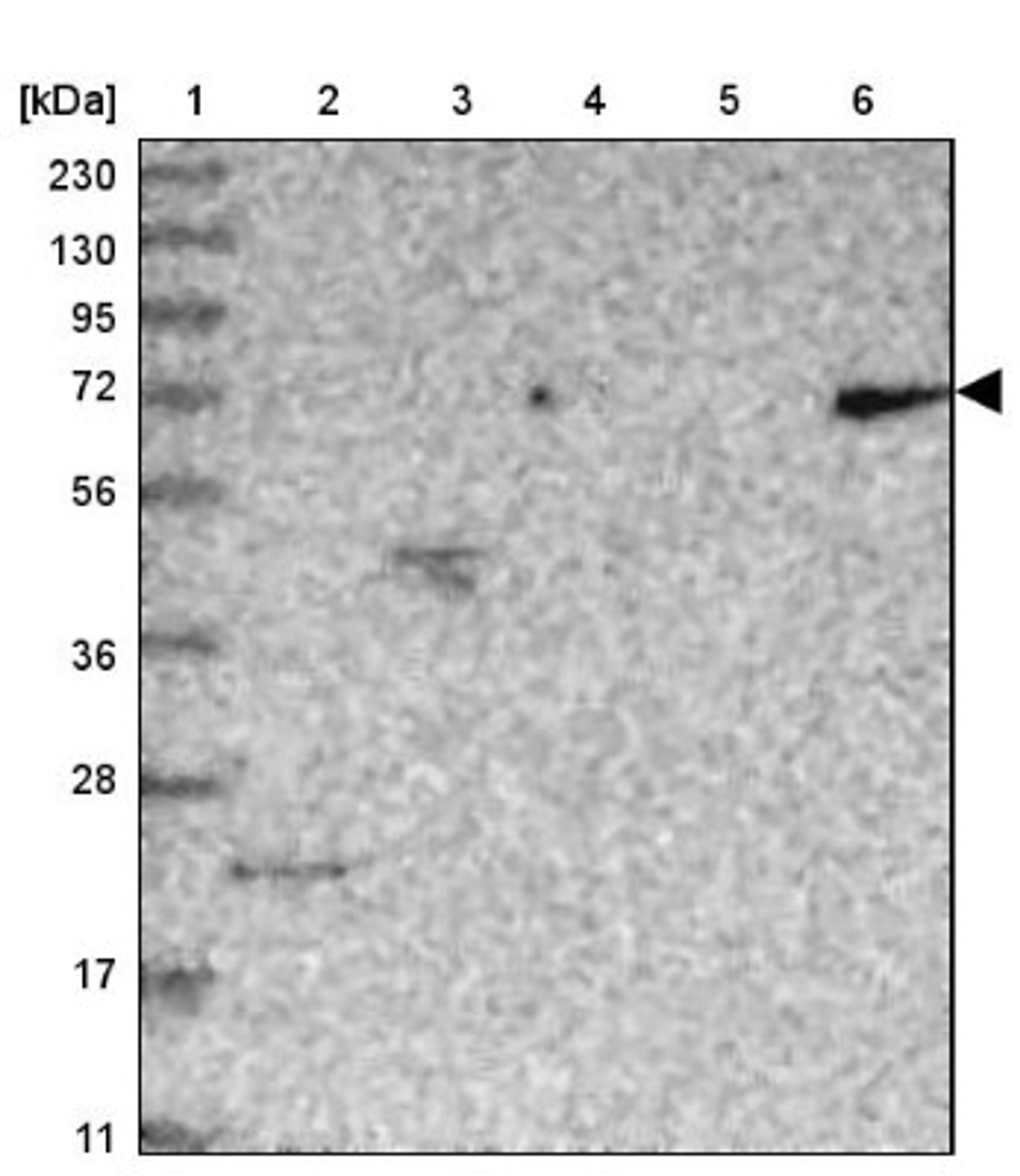 Western Blot: CCDC30 Antibody [NBP1-93963] - Lane 1: Marker [kDa] 230, 130, 95, 72, 56, 36, 28, 17, 11<br/>Lane 2: Human cell line RT-4<br/>Lane 3: Human cell line U-251MG sp<br/>Lane 4: Human plasma (IgG/HSA depleted)<br/>Lane 5: Human liver tissue<br/>Lane 6: Human tonsil tissue