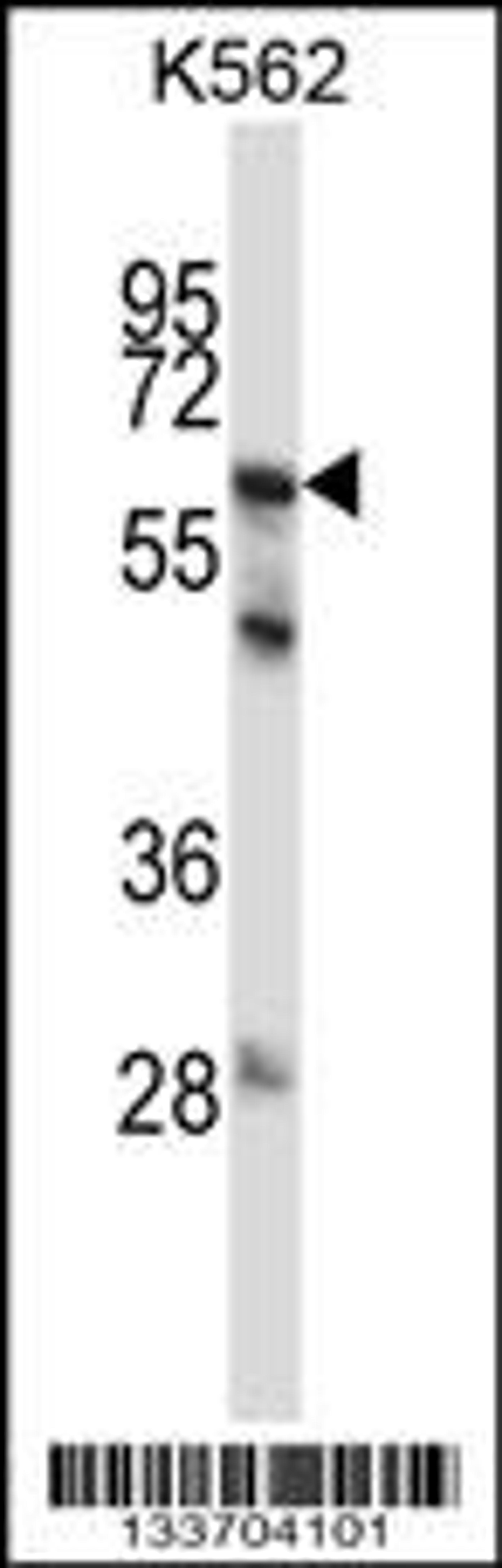 Western blot analysis in K562 cell line lysates (35ug/lane).