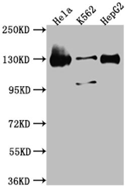 Western Blot. Positive WB detected in: Hela whole cell lysate, K562 whole cell lysate, HepG2 whole cell lysate. All lanes: Bub1 antibody at 1:1000. Secondary. Goat polyclonal to rabbit IgG at 1/50000 dilution. Predicted band size: 123, 116, 120 kDa. Observed band size: 130 kDa.