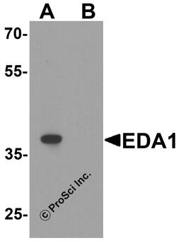 Western blot analysis of EDA1 in mouse kidney tissue lysate with EDA1 antibody at 1 μg/ml in (A) the absence and (B) the presence of blocking peptide.