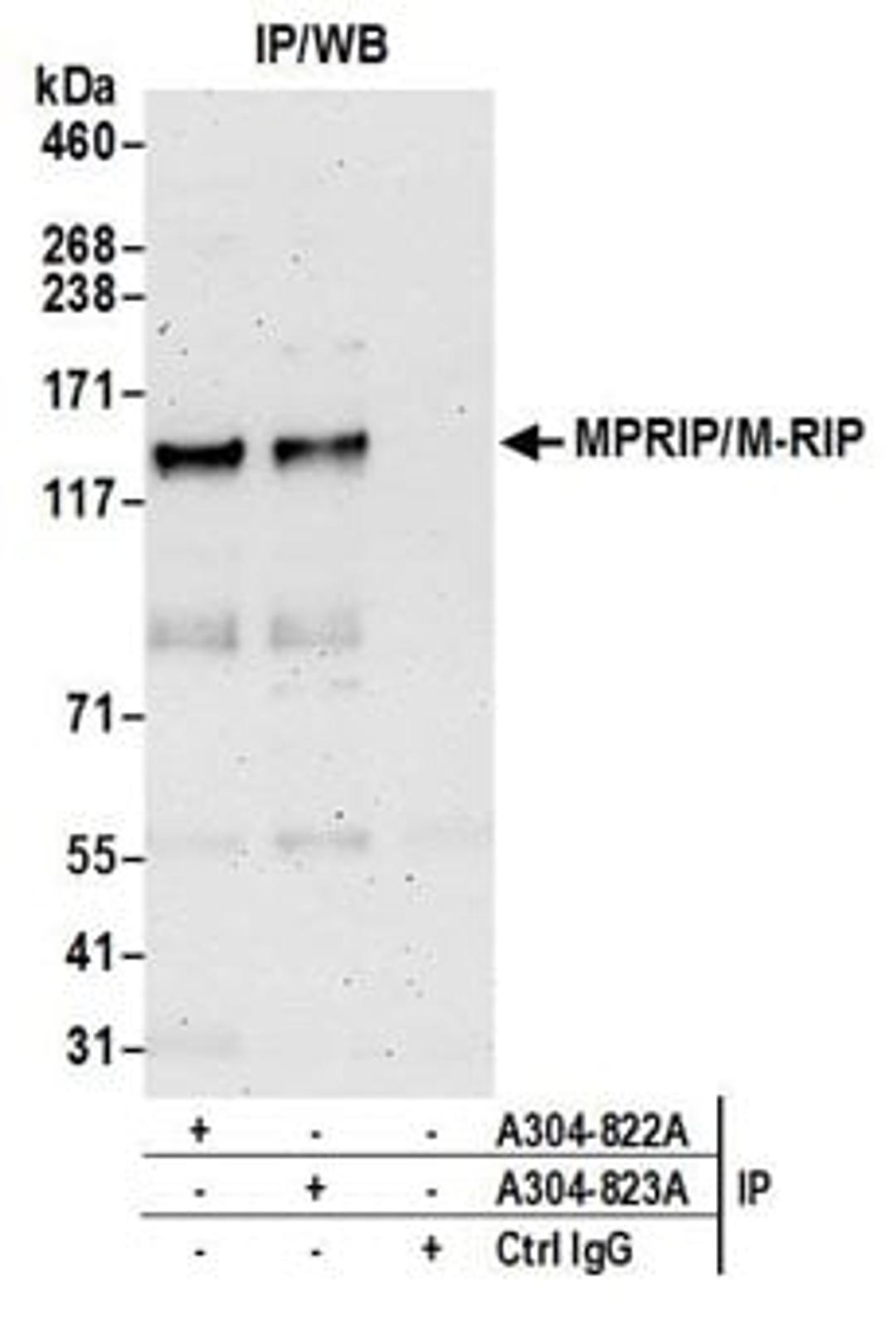 Detection of human MPRIP/M-RIP by western blot of immunoprecipitates.