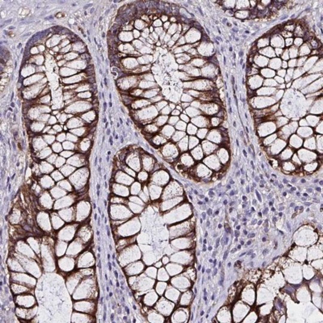 Immunohistochemistry: ZNF813 Antibody [NBP2-31638] - Staining of human rectum shows strong cytoplasmic positivity in glandular cells.