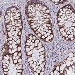 Immunohistochemistry: ZNF813 Antibody [NBP2-31638] - Staining of human rectum shows strong cytoplasmic positivity in glandular cells.