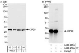 Detection of human CIP29 by western blot and immunoprecipitation.