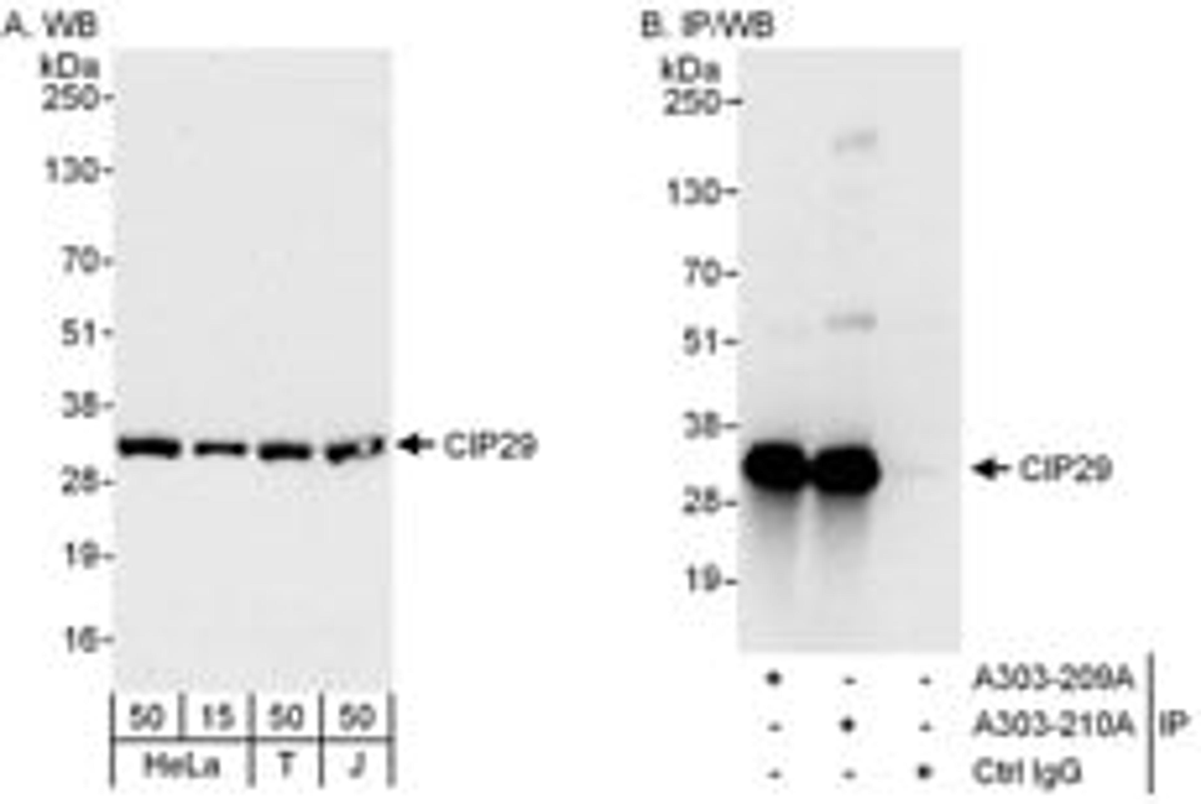 Detection of human CIP29 by western blot and immunoprecipitation.