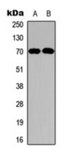 Western blot analysis of HepG2 (Lane 1), MCF7 (Lane 2) whole cell lysates using NF2 antibody