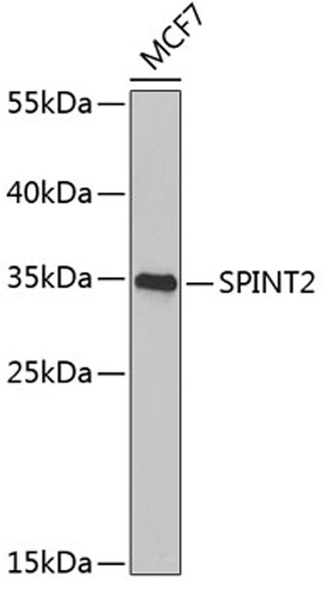 Western blot - SPINT2 Antibody (A6749)