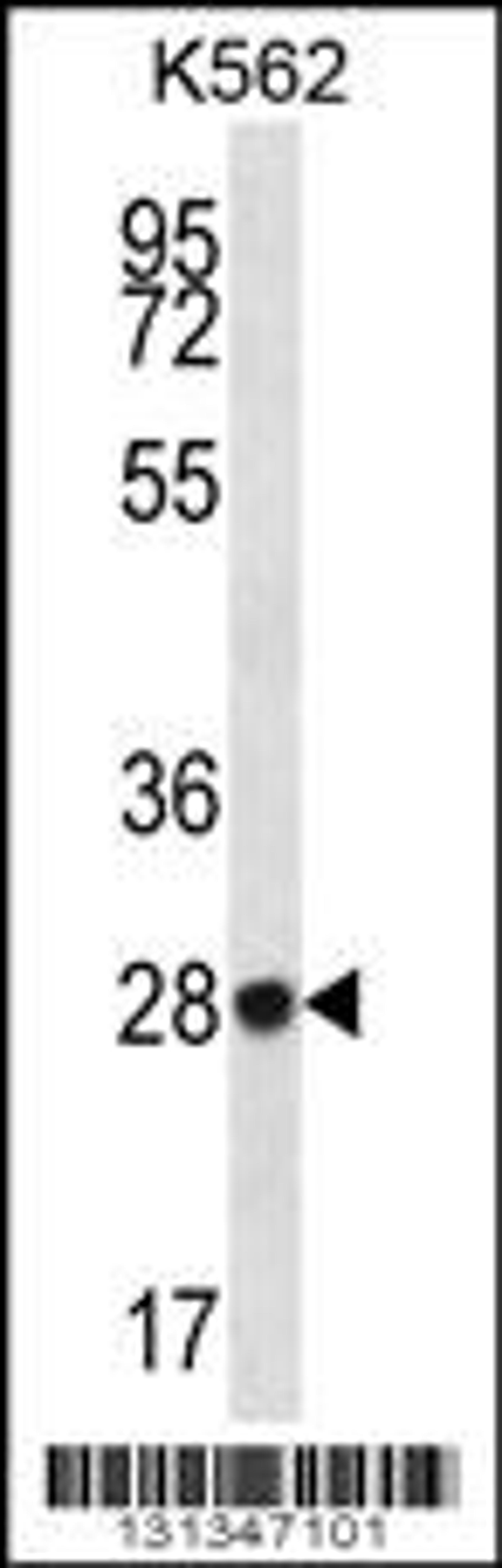 Western blot analysis in K562 cell line lysates (35ug/lane).