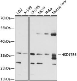 Western blot - HSD17B6 antibody (A14474)