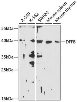 Western blot - DFFB antibody (A10110)