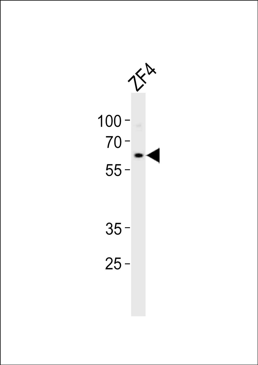 Western blot analysis of lysate from ZF4 cell line, using (DANRE) camk2d2 Antibody at 1:1000.