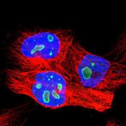 Immunocytochemistry/Immunofluorescence: Pea3 Antibody [NBP1-87960] - Staining of human cell line U-251MG shows positivity in nucleoli.