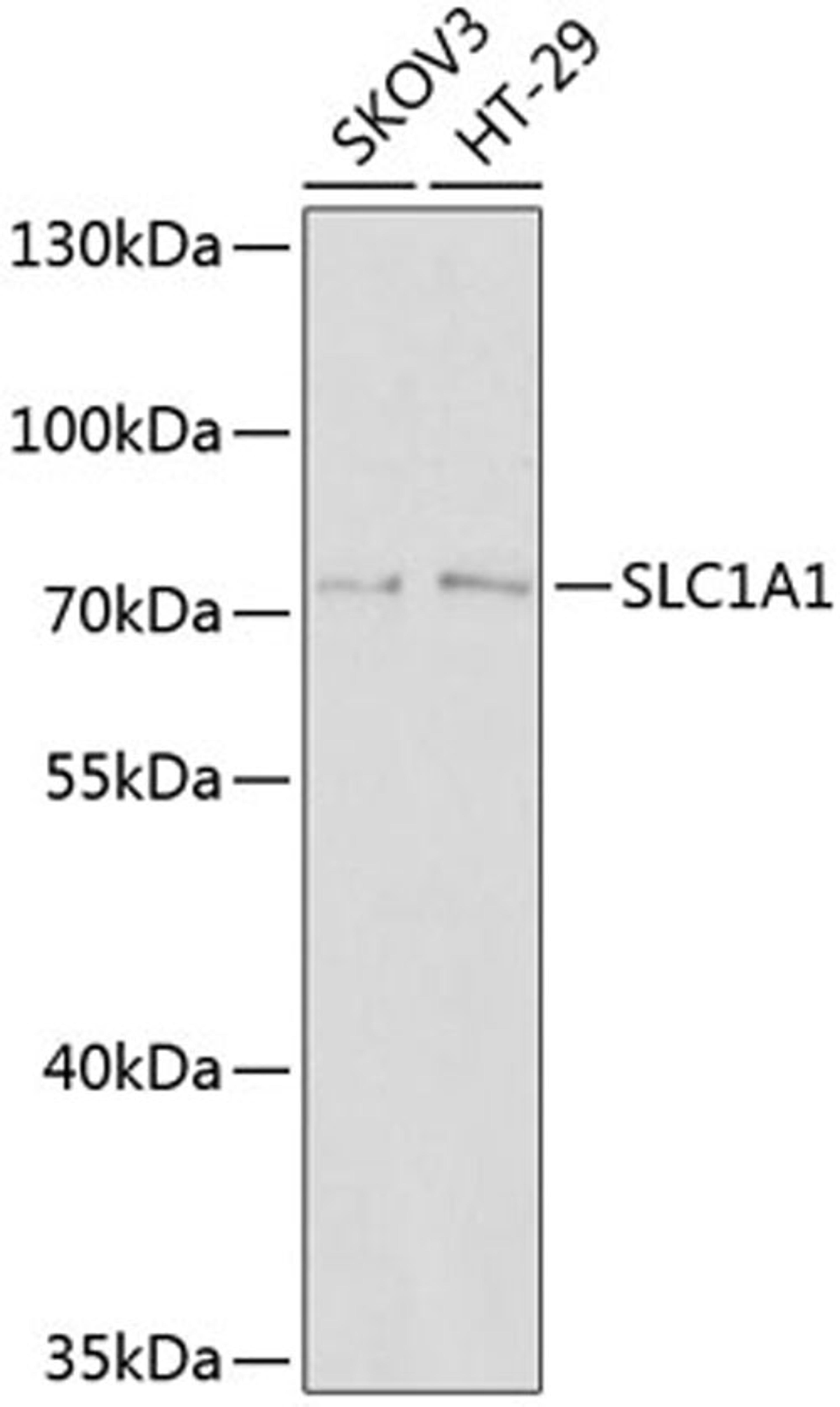 Western blot - SLC1A1 antibody (A2903)