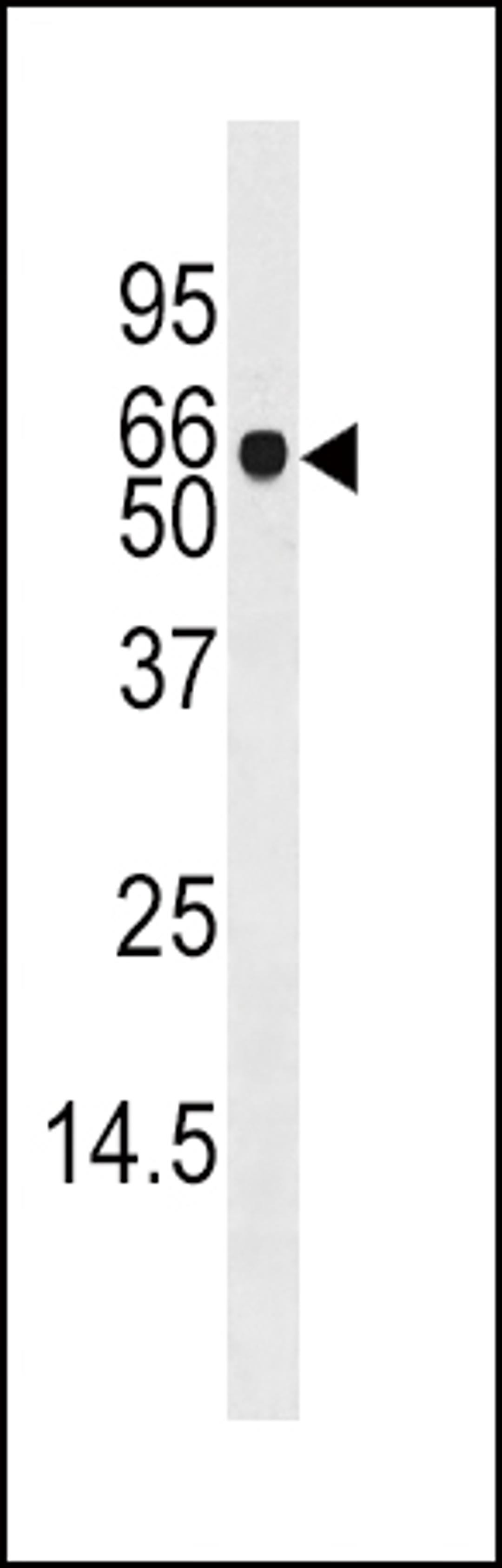 Western blot analysis of anti-ADK Pab in mouse liver tissue lysate (35ug/lane)