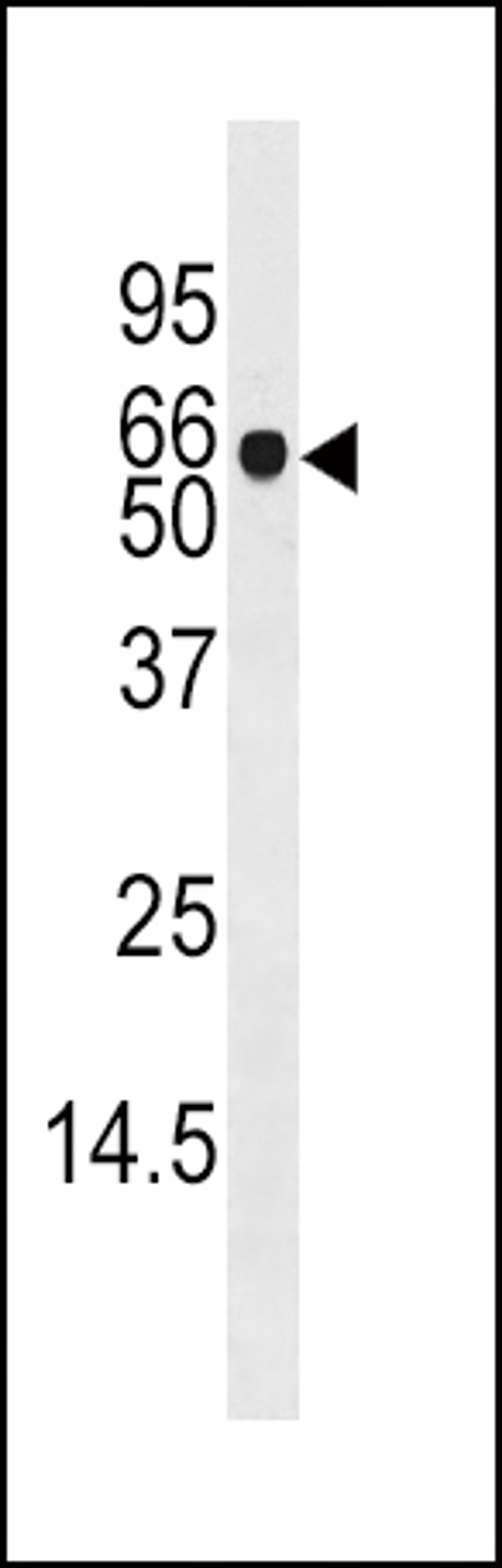 Western blot analysis of anti-ADK Pab in mouse liver tissue lysate (35ug/lane)