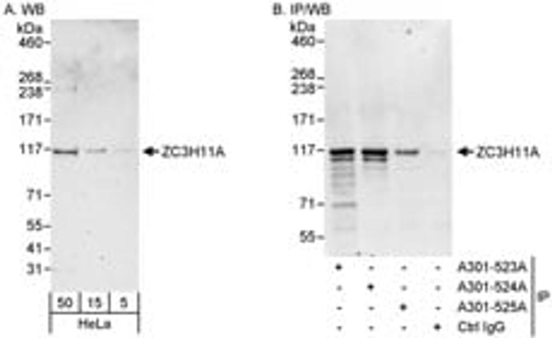 Detection of human ZC3H11A by western blot and immunoprecipitation.