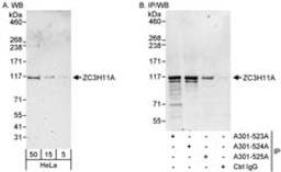 Detection of human ZC3H11A by western blot and immunoprecipitation.