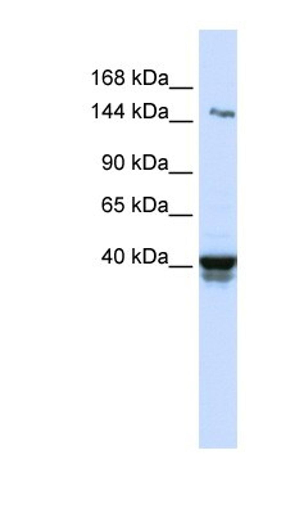 Western Blot: IGSF9 Antibody [NBP1-91340] - Human Lung lysate, concentration 0.2-1 ug/ml.