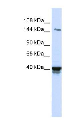 Western Blot: IGSF9 Antibody [NBP1-91340] - Human Lung lysate, concentration 0.2-1 ug/ml.