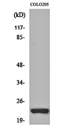 Western blot analysis of COLO205 cell lysates using NEEP21 antibody