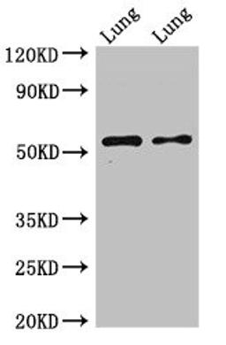Western Blot. Positive WB detected in: Rat lung tissue, Mouse lung tissue. All lanes: HTR3A antibody at 2.5ug/ml. Secondary. Goat polyclonal to rabbit IgG at 1/50000 dilution. Predicted band size: 56, 59, 54, 60 kDa. Observed band size: 56 kDa.