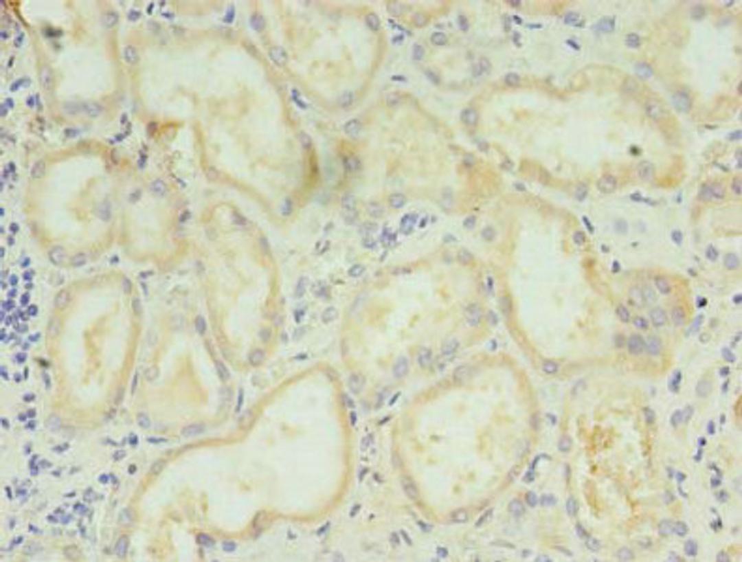 Immunohistochemistry of paraffin-embedded human kidney tissue using CSB-PA736204LA01HU at dilution of 1:100