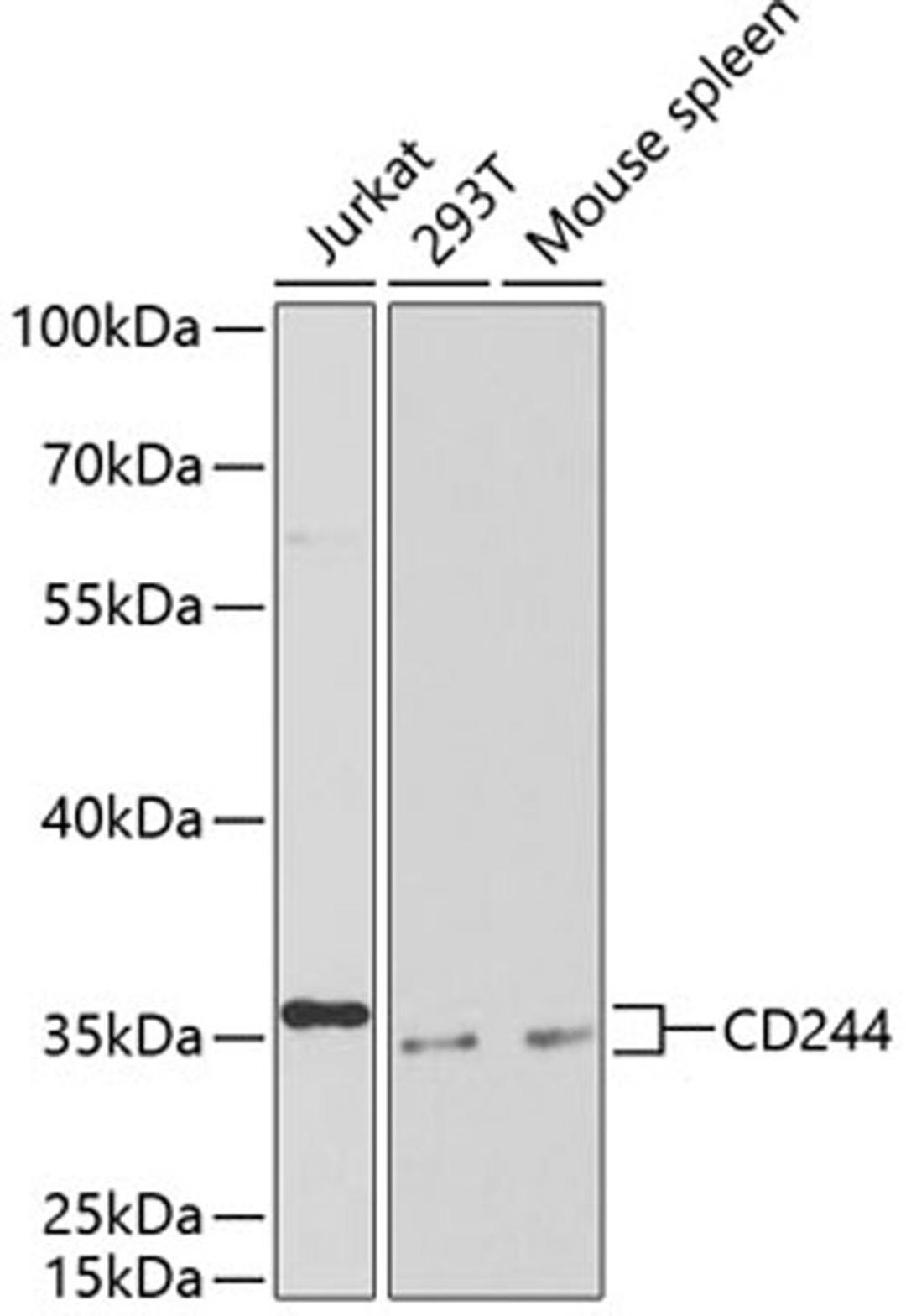 Western blot - CD244 antibody (A1993)