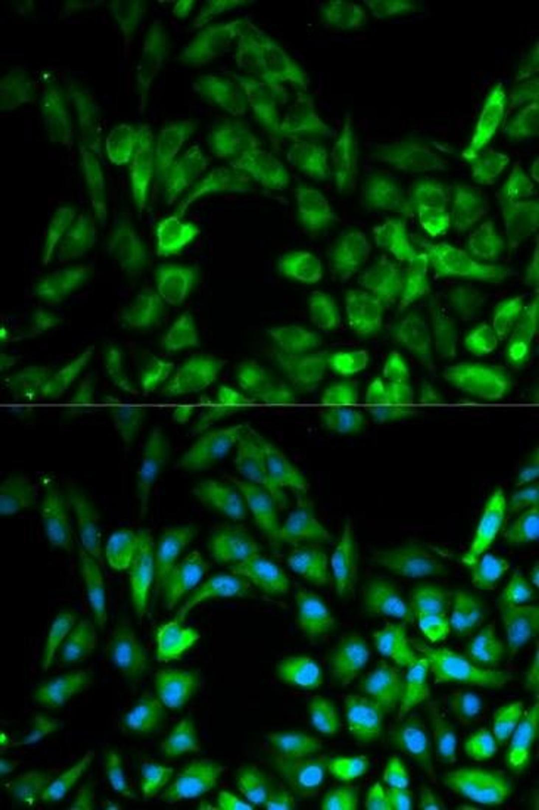 Immunofluorescense analysis of MCF7 cell using IKBKG antibody