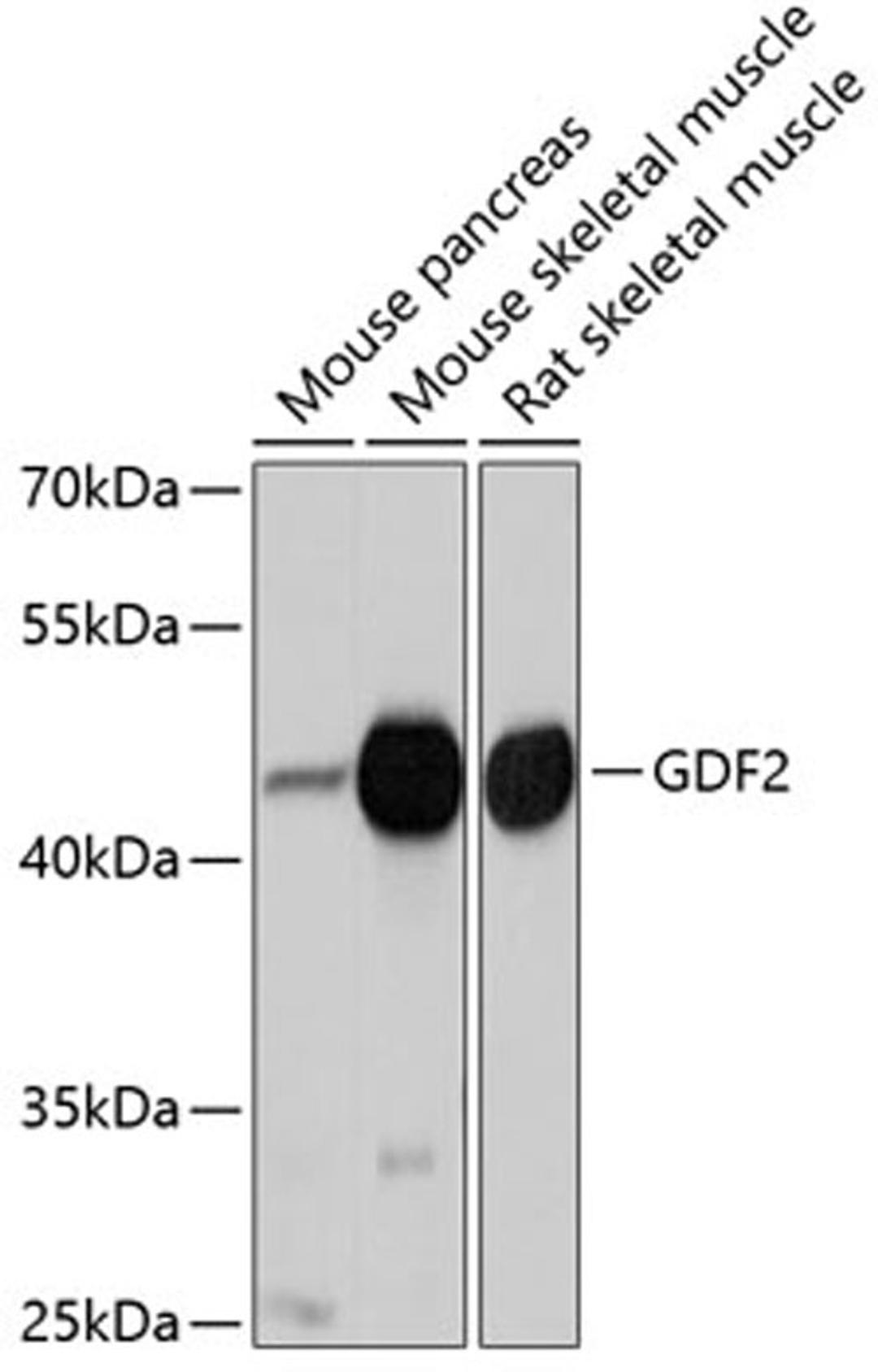 Western blot - GDF2 antibody (A10537)