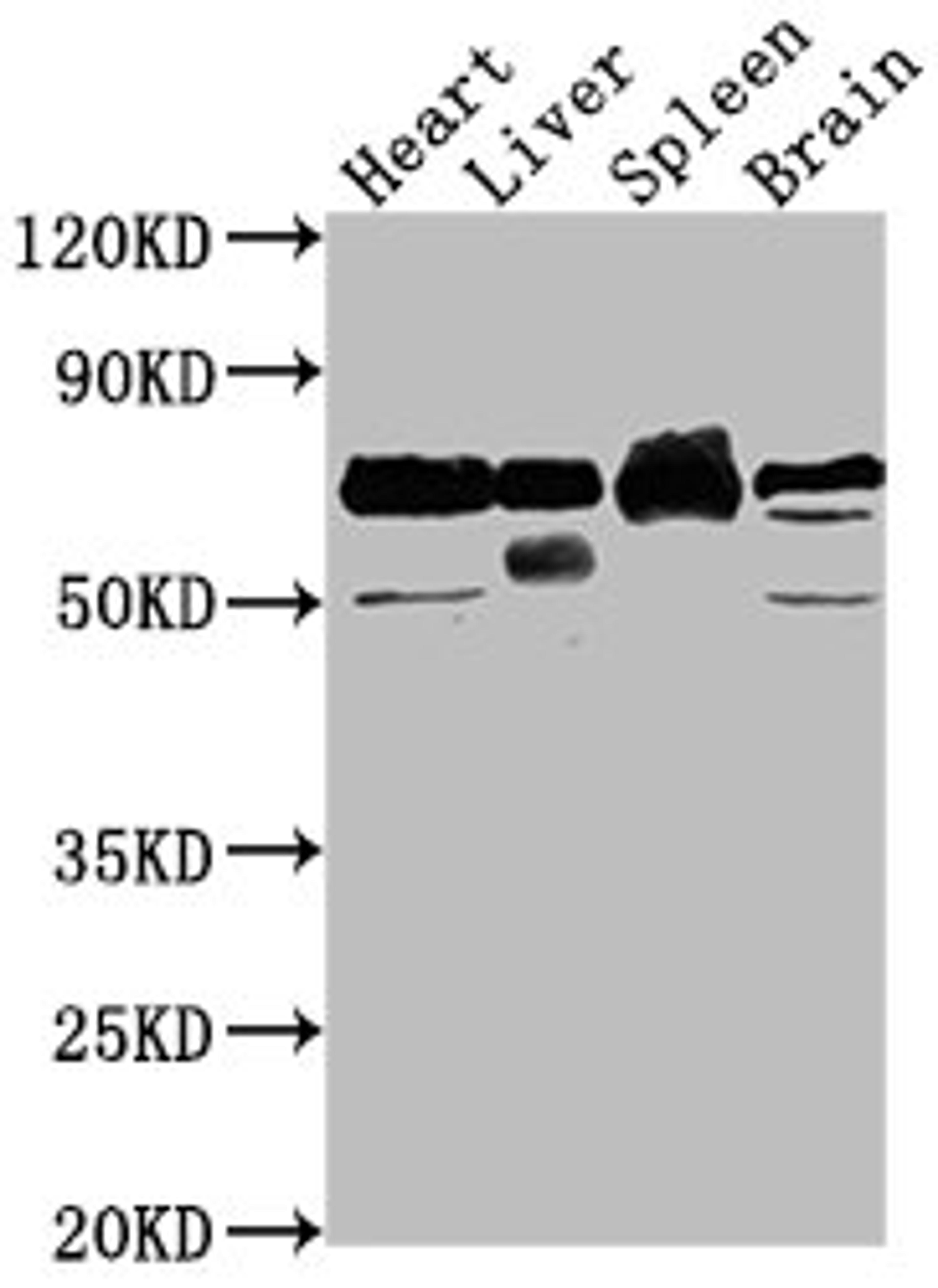 Western Blot. Positive WB detected in: Rat heart tissue, Rat liver tissue, Rat spleen tissue, Rat brain tissue. All lanes: Alb antibody at 1:2000. Secondary. Goat polyclonal to rabbit IgG at 1/50000 dilution. Predicted band size: 69 kDa. Observed band size: 69 kDa. 