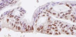 Detection of human SMC3 by immunohistochemistry.