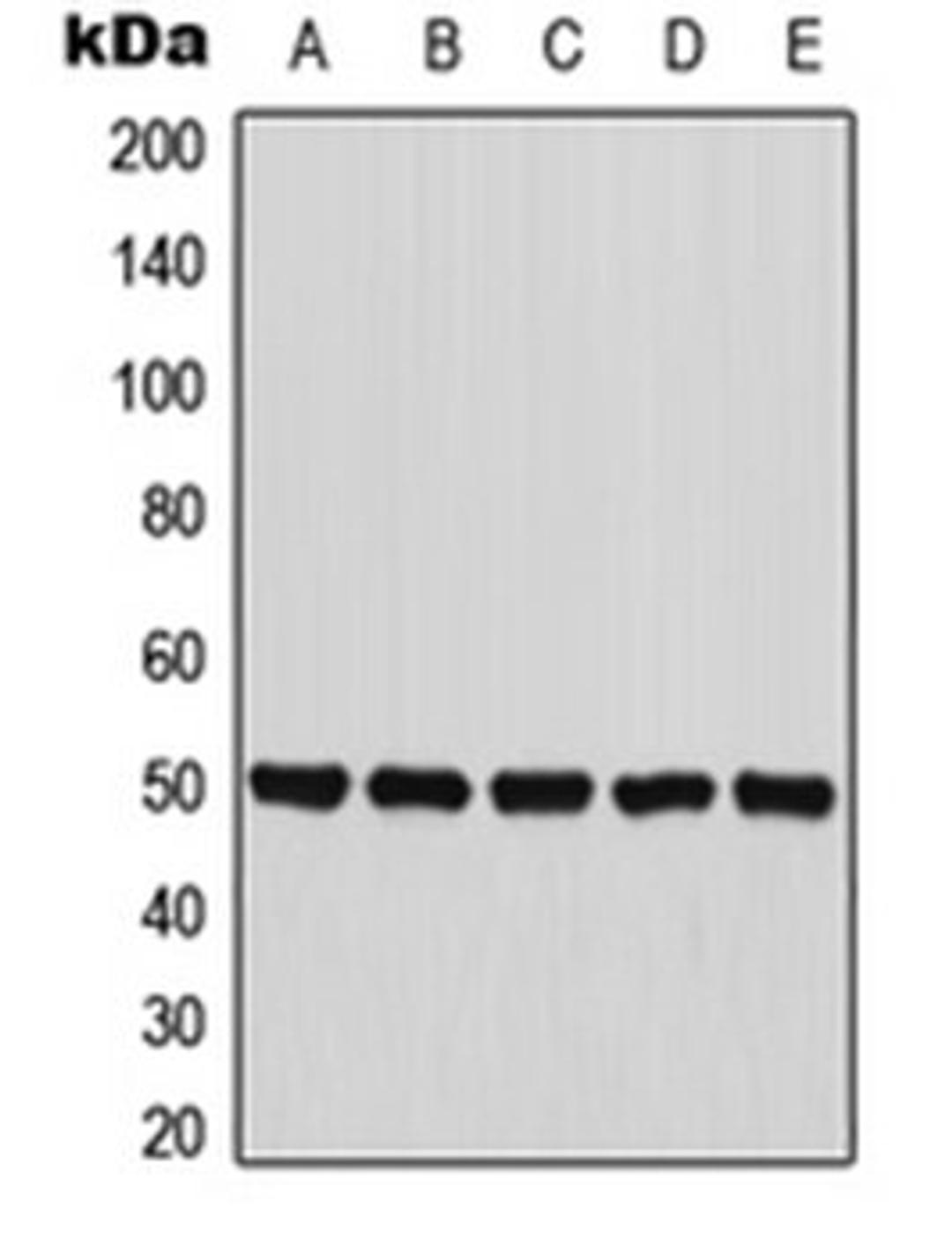 Western blot analysis of HepG2 (Lane 1), MCF7 (Lane 2), HT29 (Lane 3), mouse liver (Lane 4), PC12 (Lane 5) whole cell lysates using PANK2 antibody