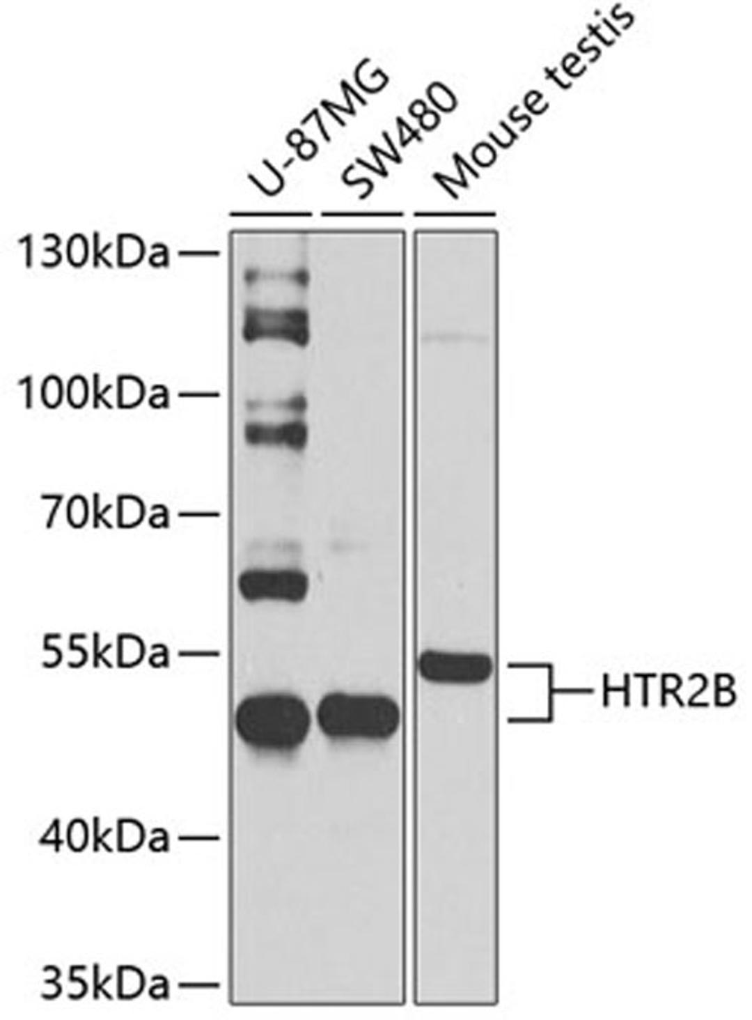 Western blot - HTR2B Antibody (A2651)