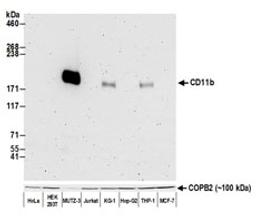 Detection of human CD11b by western blot.