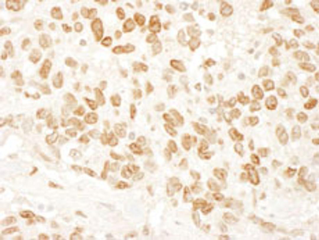 Detection of human ARID4B by immunohistochemistry.