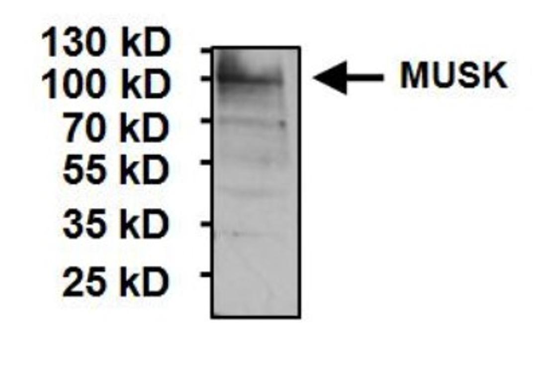 Western Blot: MuSK Antibody [NB120-5619] - Analysis of 30ug of rat skeletal muscle tissue lysate and 10ul PageRuler Plus Prestained Protein Ladder per well onto a 4-20% Tris-Glycine polyacrylamide gel.