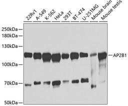 Western blot - AP2B1 antibody (A1995)