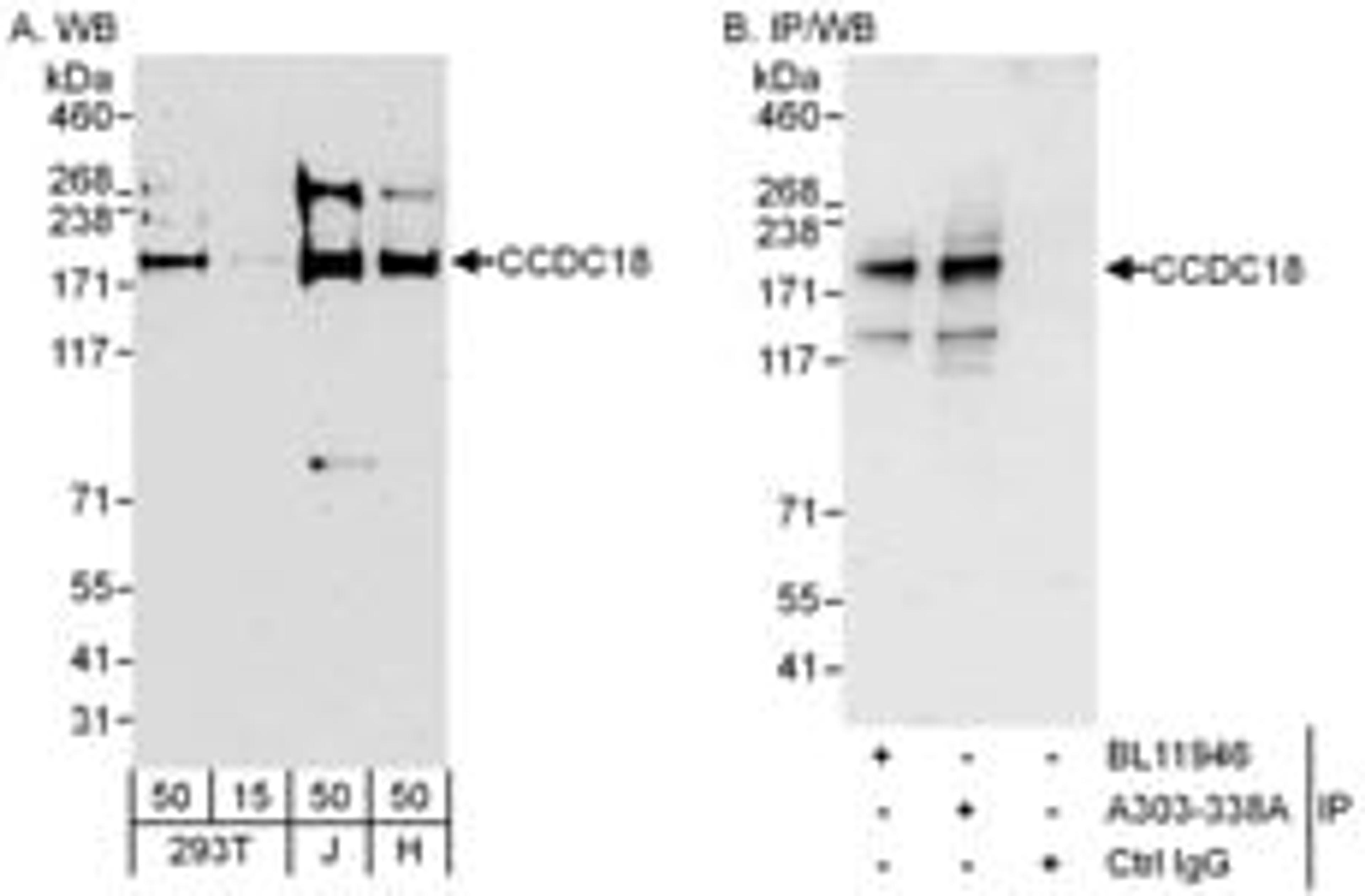 Detection of human CCDC18 by western blot and immunoprecipitation.