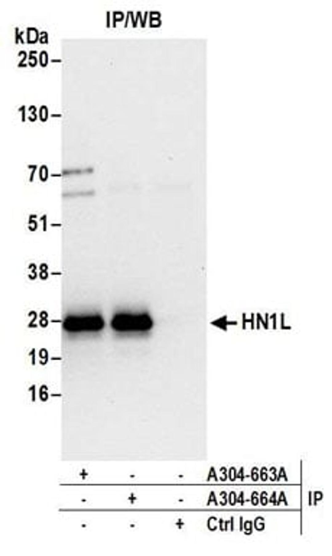 Detection of human HN1L by western blot of immunoprecipitates.