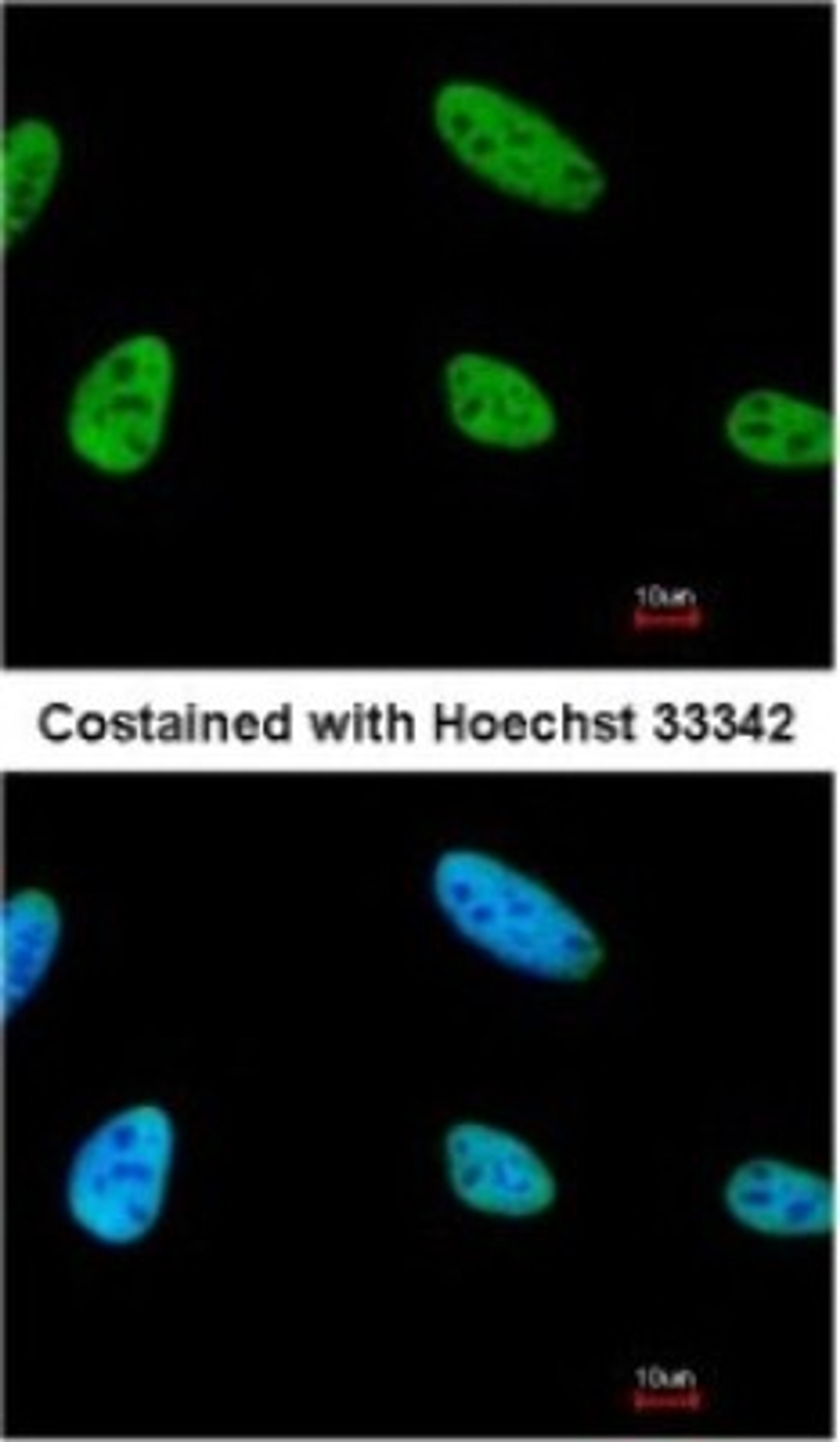 Immunocytochemistry/Immunofluorescence: NPAS2 Antibody [NBP1-31363] - Paraformaldehyde-fixed HeLa, using antibody at 1:200 dilution.