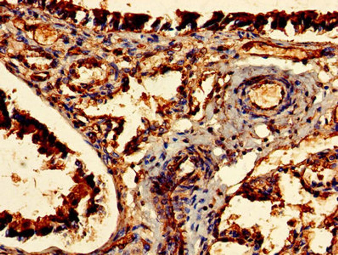 Immunohistochemistry of paraffin-embedded human lung tissue using CSB-PA005103LA01HU at dilution of 1:100