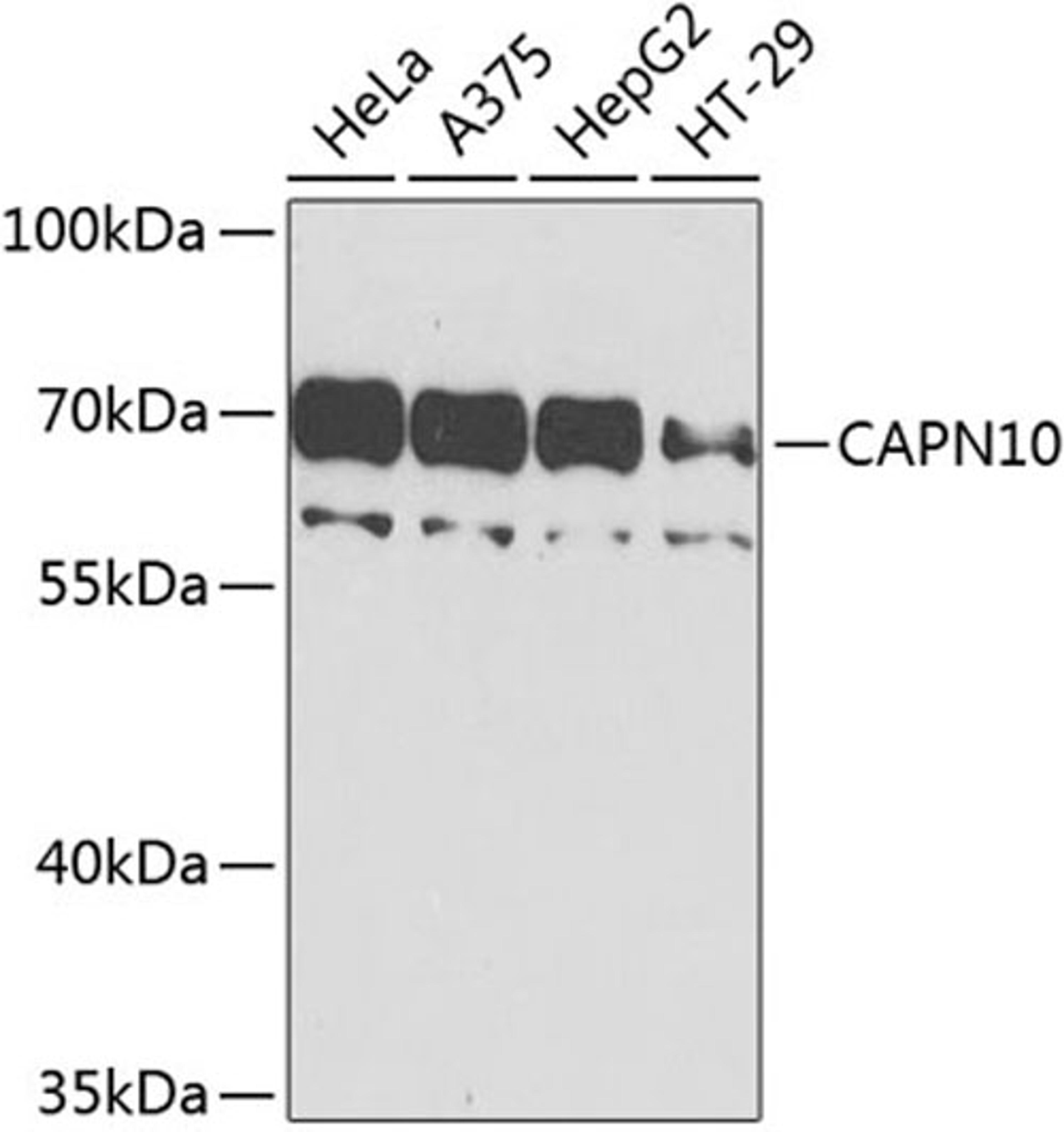 Western blot - CAPN10 antibody (A9865)