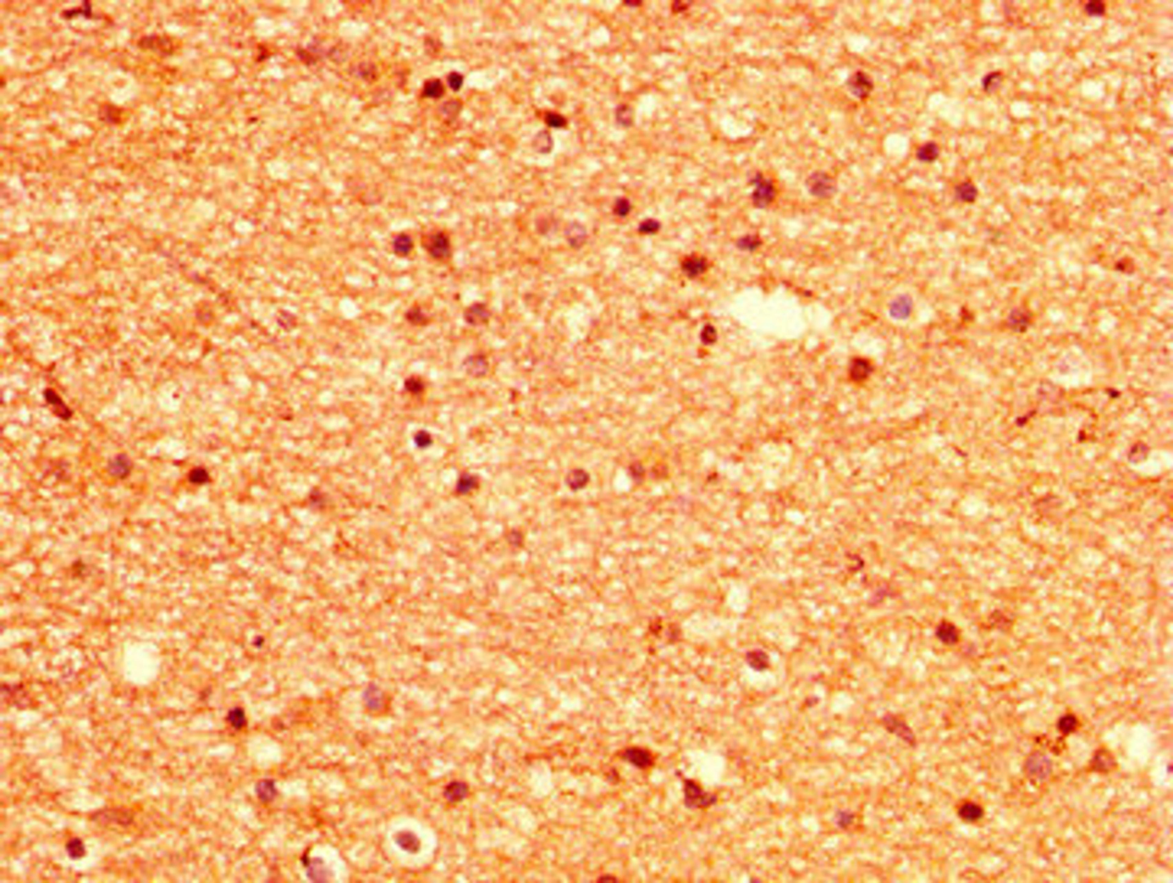 IHC image of CSB-PA015033LA01HU diluted at 1:500 and staining in paraffin-embedded human brain tissue performed on a Leica BondTM system. After dewaxing and hydration, antigen retrieval was mediated by high pressure in a citrate buffer (pH 6.0). Section was blocked with 10% normal goat serum 30min at RT. Then primary antibody (1% BSA) was incubated at 4&deg;C overnight. The primary is detected by a biotinylated secondary antibody and visualized using an HRP conjugated SP system.