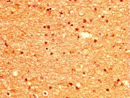 IHC image of CSB-PA015033LA01HU diluted at 1:500 and staining in paraffin-embedded human brain tissue performed on a Leica BondTM system. After dewaxing and hydration, antigen retrieval was mediated by high pressure in a citrate buffer (pH 6.0). Section was blocked with 10% normal goat serum 30min at RT. Then primary antibody (1% BSA) was incubated at 4°C overnight. The primary is detected by a biotinylated secondary antibody and visualized using an HRP conjugated SP system.