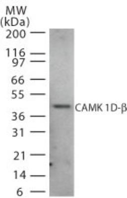 Western Blot: CaMKID beta Antibody [NB120-22043] - Analysis of CAMK 1D-beta in human brain cell lysate using this antibody at 2 ug/ml.