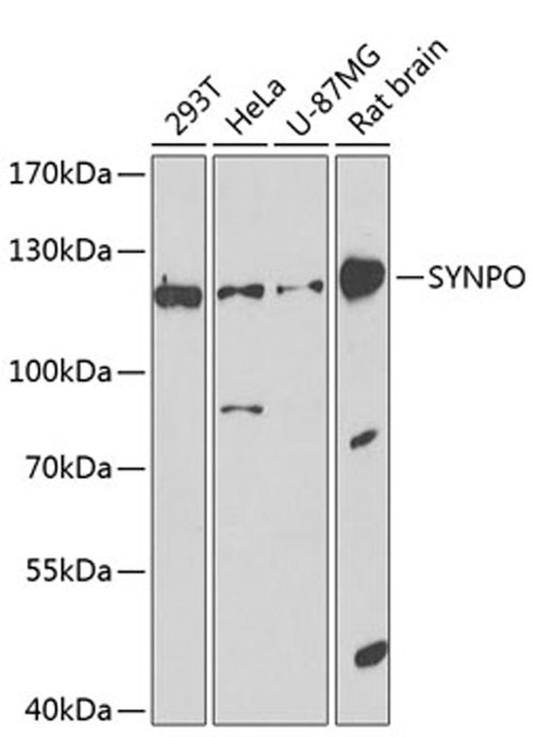 Western blot - SYNPO antibody (A8484)