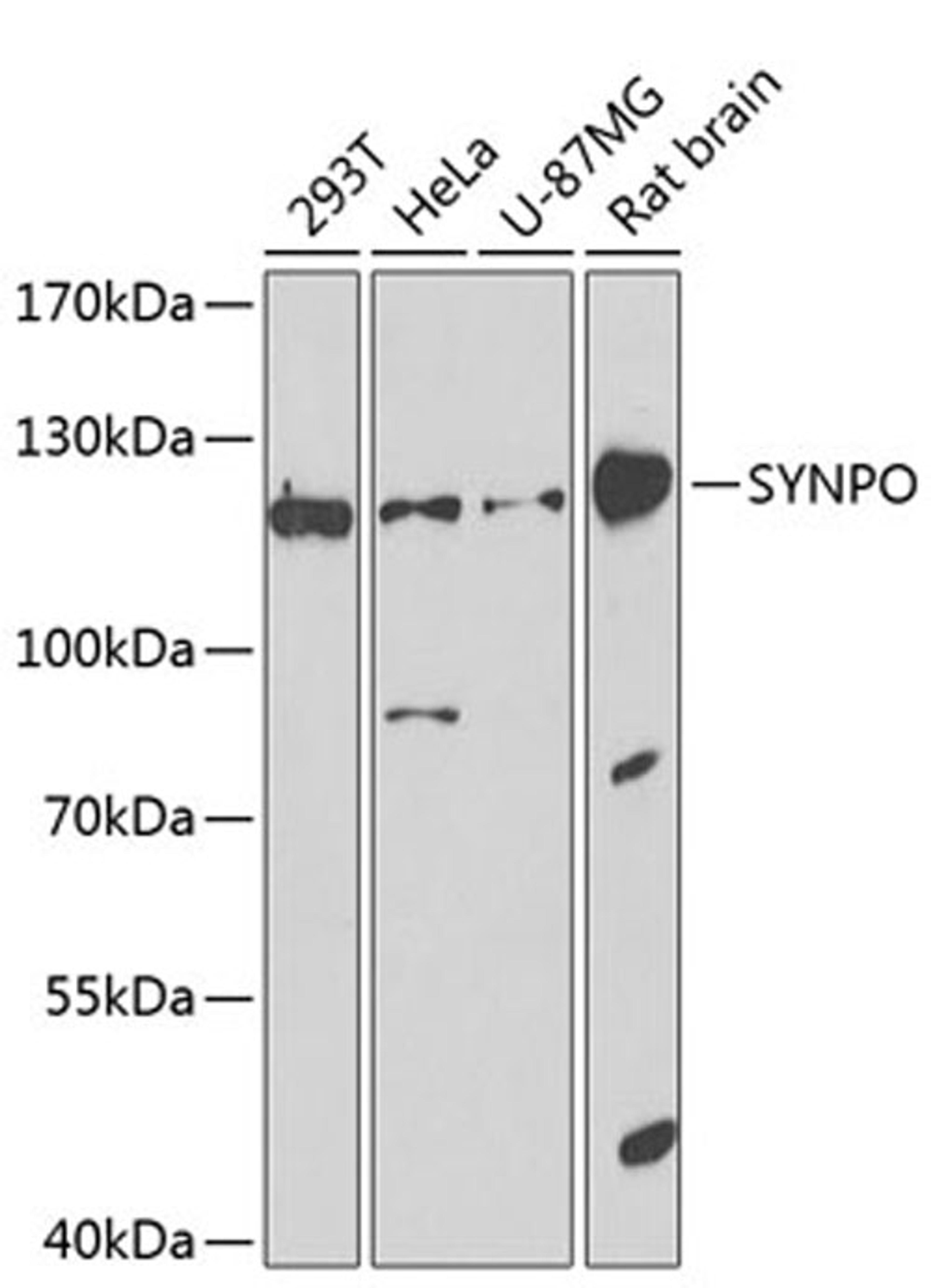 Western blot - SYNPO antibody (A8484)