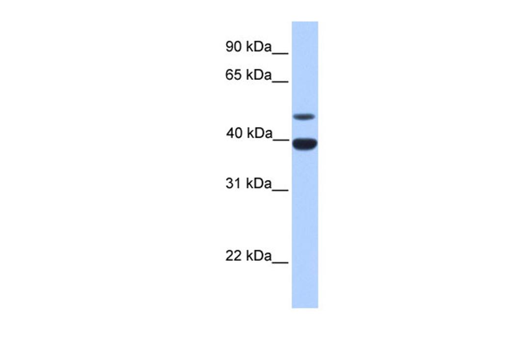 Antibody used in WB on Human Liver at 0.2-1 ug/ml.