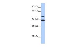 Antibody used in WB on Human Liver at 0.2-1 ug/ml.