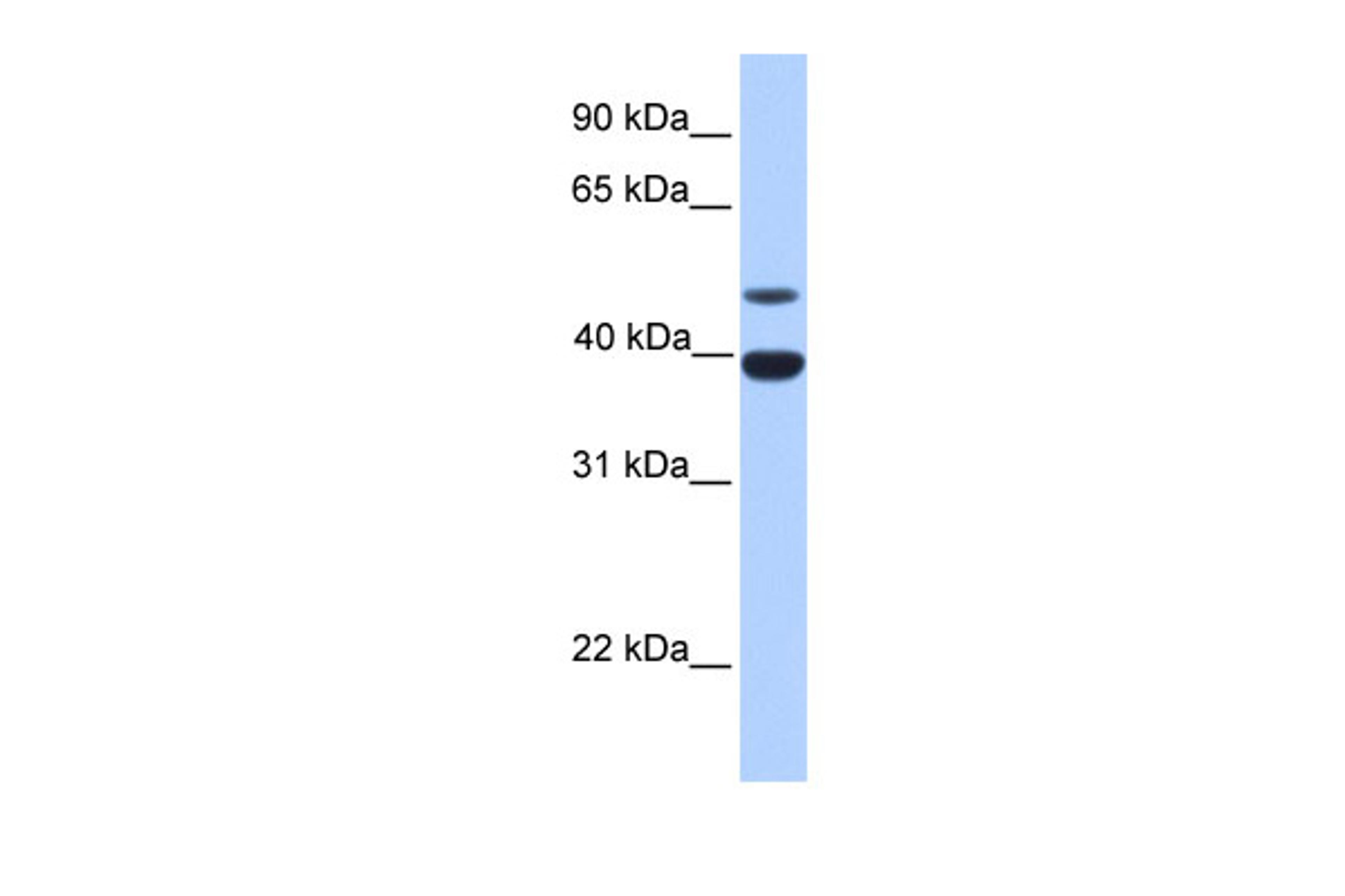 Antibody used in WB on Human Liver at 0.2-1 ug/ml.